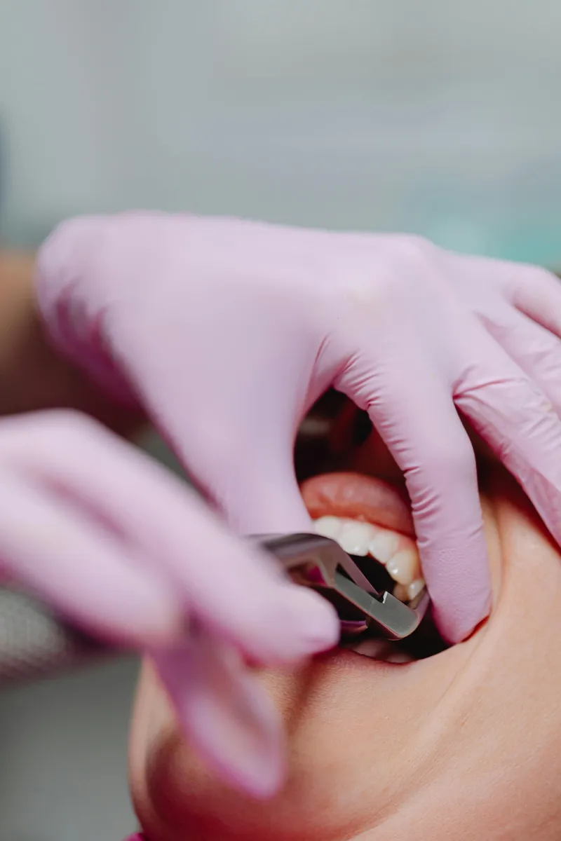 Routine dental cleaning in Newark NJ